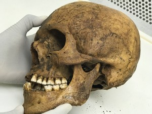 Figura 2:crânio de uma múmia usada no estudo. Fonte [2]