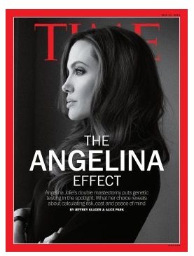 Inside the 'Angelina Jolie effect' on breast reconstruction
